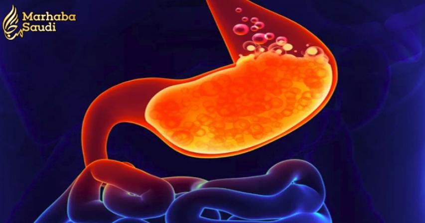 Do you have an acid reflux problem?
