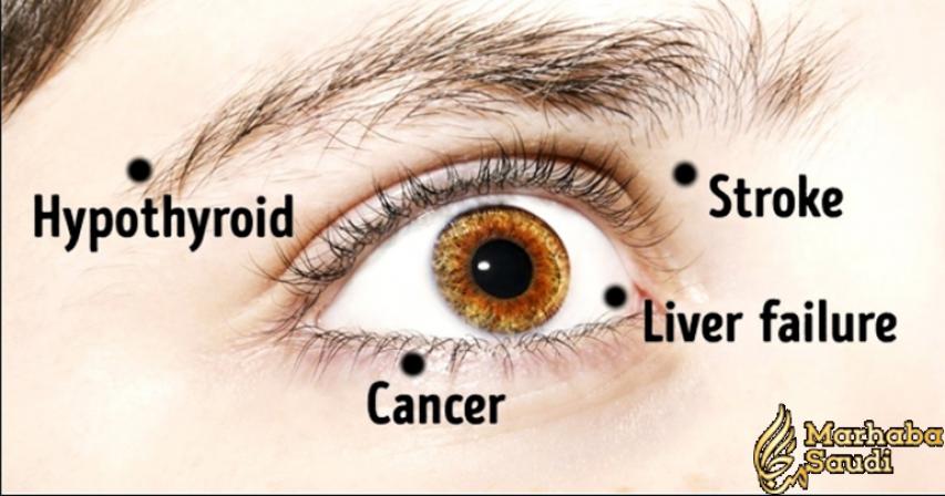 8 Things Your Eyes Are Trying To Tell You About Your Health