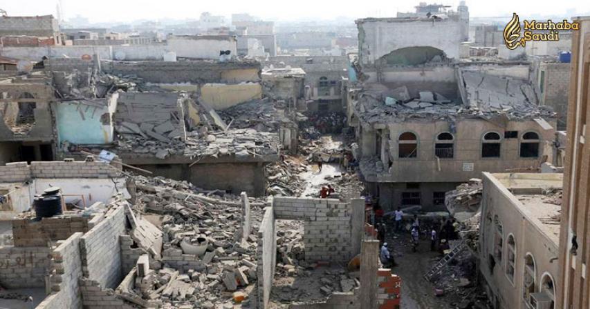 Saudi team ready to treat conjoined twins
