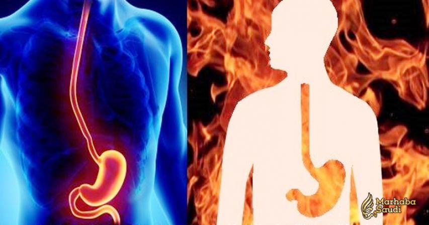 Proven Home Remedies for Heartburn (Acid Reflux) & Natural Antacids

