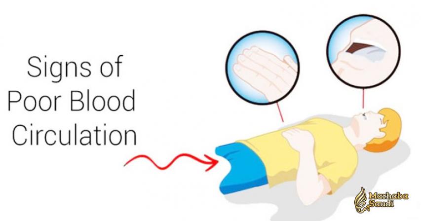 5 Warning Signs of Poor Blood Circulation
