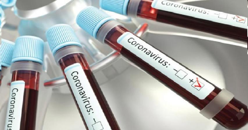 Saudi Arabia records 1299 confirmed cases and  8 deaths