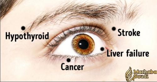 8 Things Your Eyes Are Trying To Tell You About Your Health