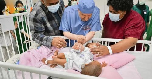 Saudi Arabia Executes Monumental Surgery to Separate Fijian Conjoined Twins