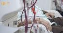 Australian Medical Researchers Execute Massive Kidney Dialysis Clinical Trial